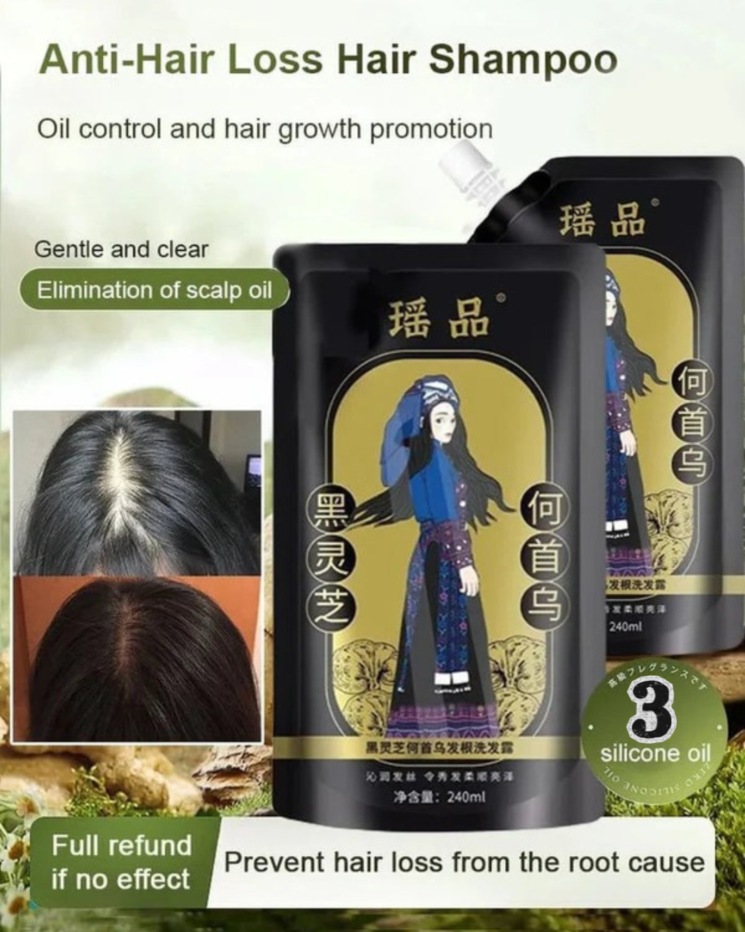 ✨🎁Hot Sale Ginger Plant Extract Anti-Hair Loss Hair Shampoo✨ BUY 1 GET 2 FREE🎁